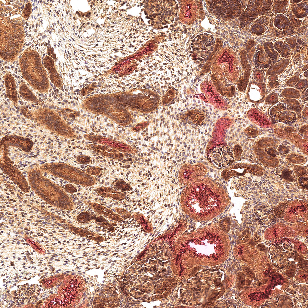 sars-cov-2 gene expression in a human fetus